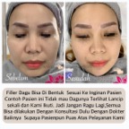 filler_dagu2_testi.jpg