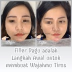 filler_dagu_testi.jpg